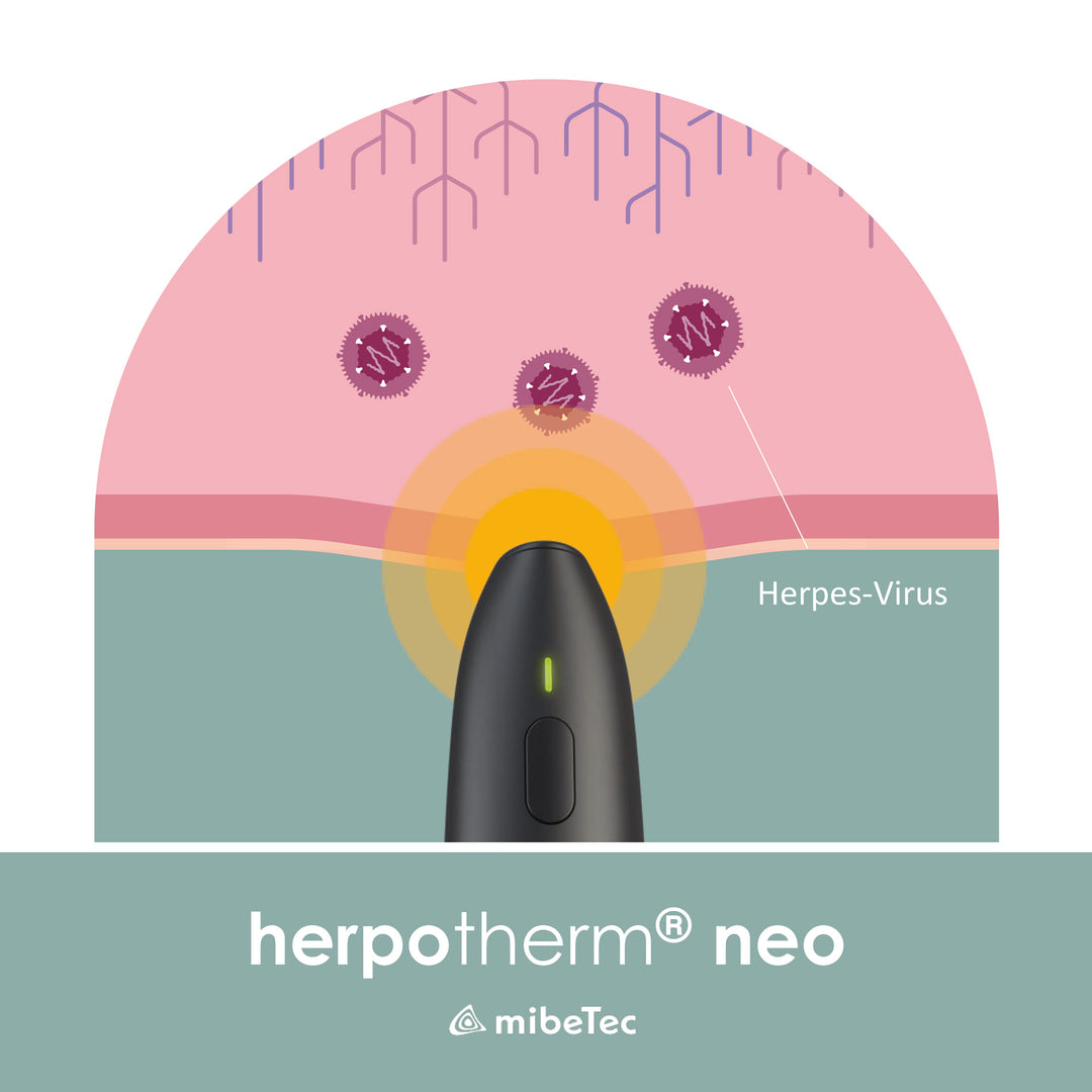 mibeTec herpotherm® neo